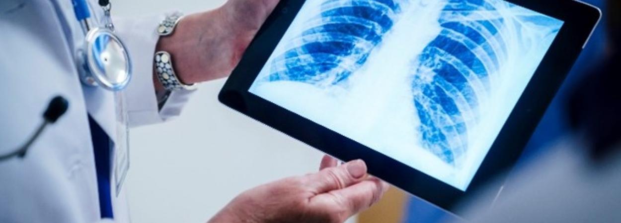 mãos de médico empunham tablet com imagem de radiografia 