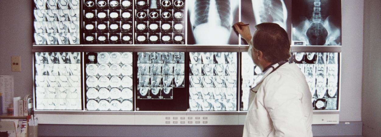 médico analisando radiografias