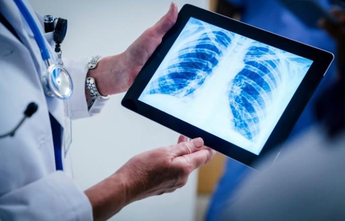 mãos de médico empunham tablet com imagem de radiografia 